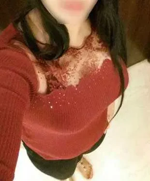 Delhi Escort